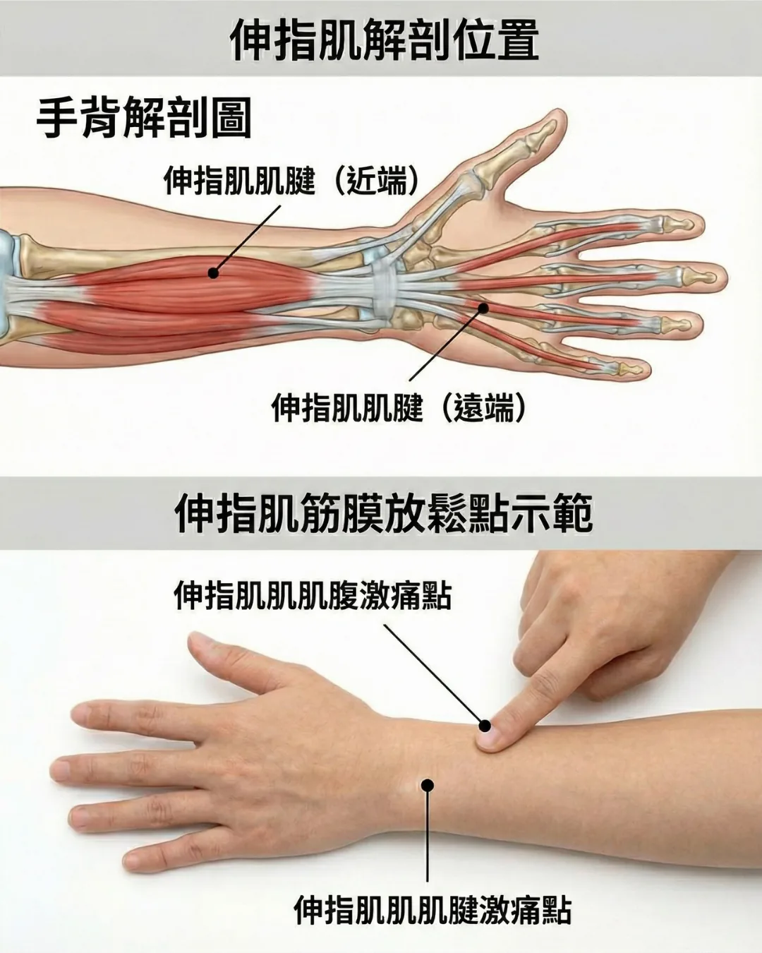 伸指肌放鬆點
