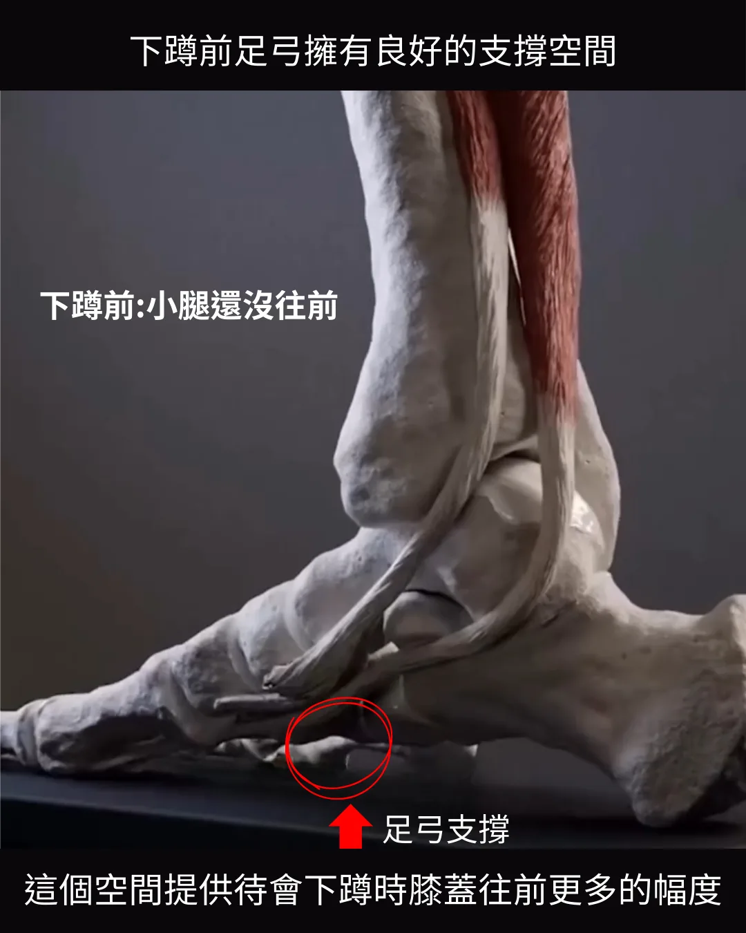深蹲前足弓支撐狀態
