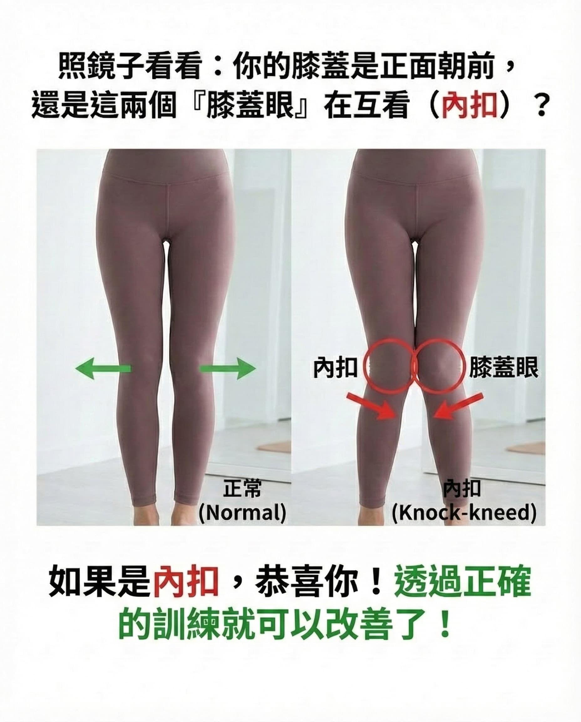 膝蓋內扣自我檢測