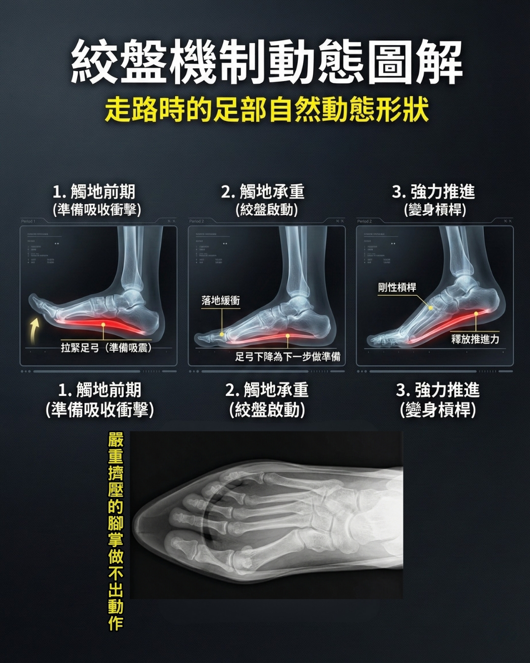 腳趾失能引發的全身性代償連鎖反應圖示