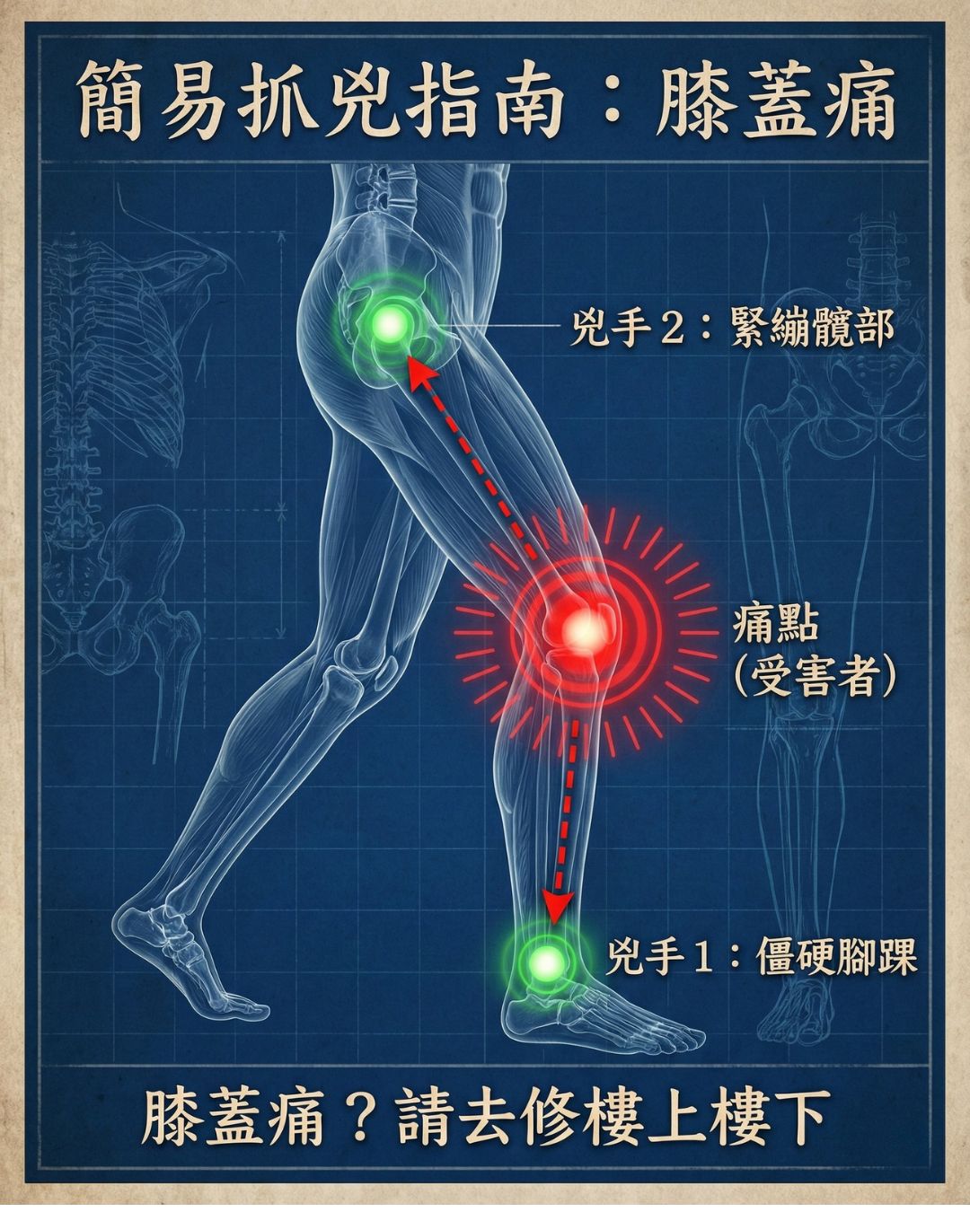 常見痠痛區域與代償關節圖示