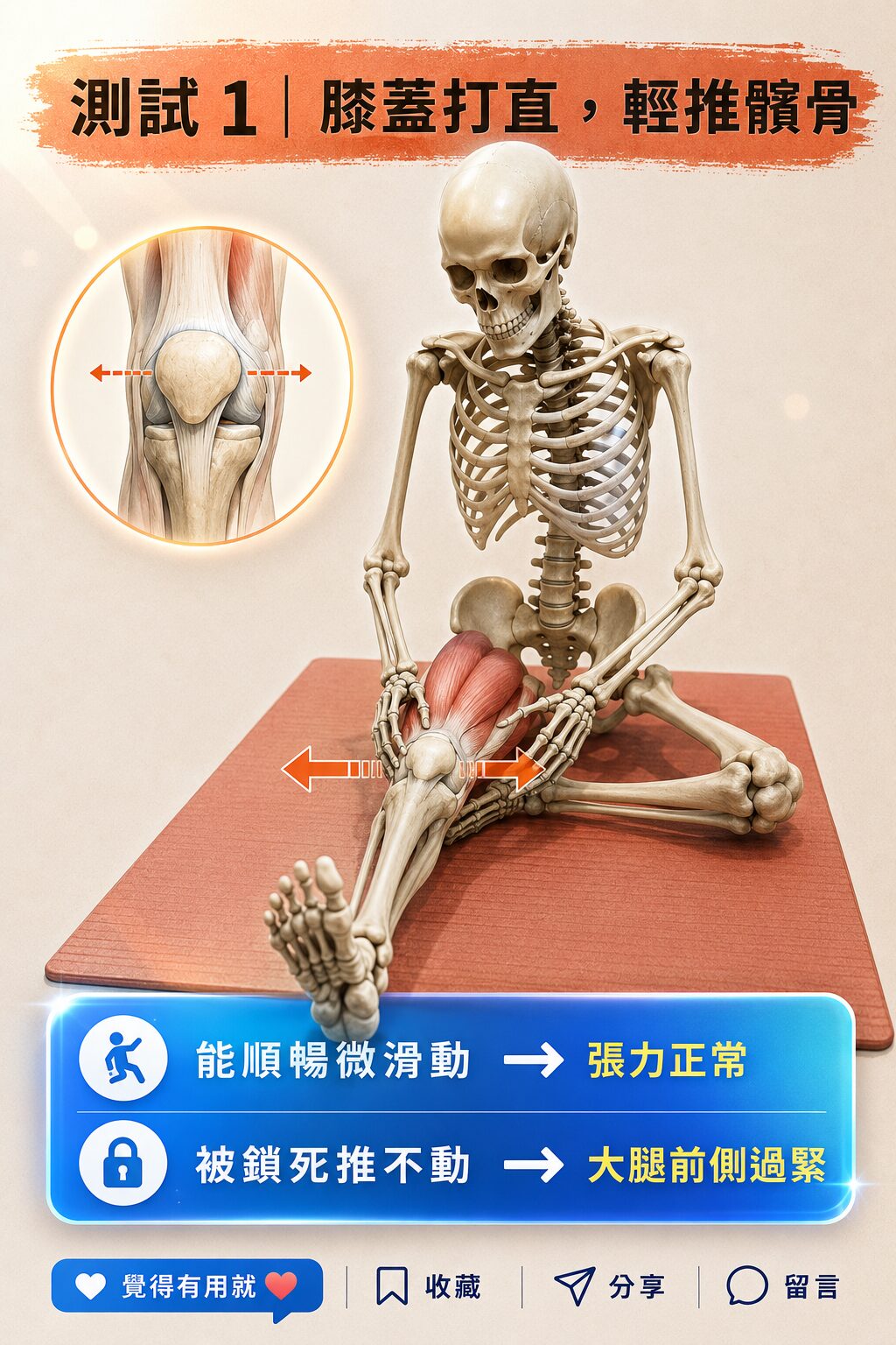 髕骨放鬆自我測試示意