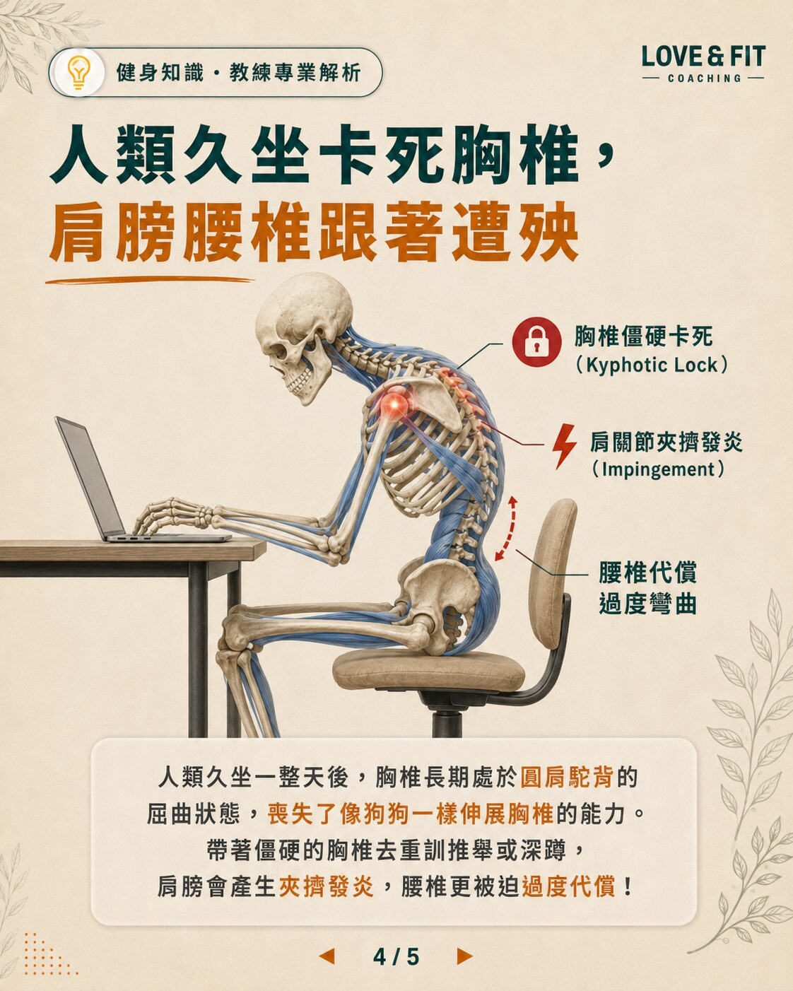人類久坐胸椎代償示意圖