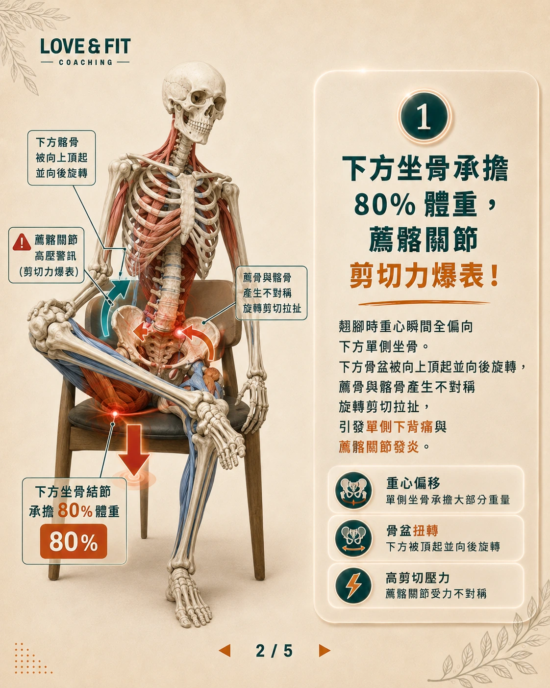 下方骨盆薦髂關節剪切力示意圖